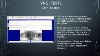 Videonystagmography VNG Intro [upl. by Jedidiah294]