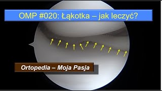 Łąkotka  jak leczyć Jakie postępowanie po operacji  OMP020 [upl. by Hamlani]