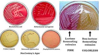 MacConkey Agar [upl. by Jenne714]