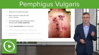 Pemphigus Vulgaris – Dermatology  Lecturio [upl. by Acim892]