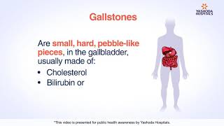 Primary Sclerosing Cholangitis Visual Explanation for Students [upl. by Nwadal]