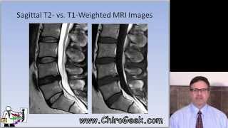 Dr Gillard lectures on How to Read Your Lumbar MRI [upl. by Debbi324]