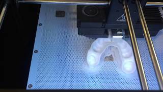 Fabrication prothèse dentaire avec Imprimante 3D [upl. by Aimaj]