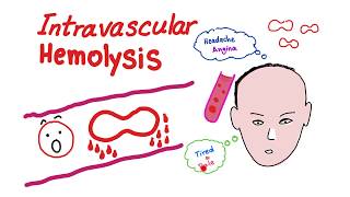 Intravascular Hemolysis [upl. by Bartholomew837]