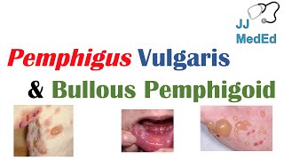 Vesiculobullous Skin Diseases  Pemphigus Vulgaris vs Bullous Pemphigoid [upl. by Jankey]