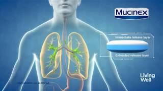 Treating Excess Mucus With Mucinex® Living Well [upl. by Eenoj]