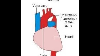 How is the Aorta Monitored [upl. by Daphna]