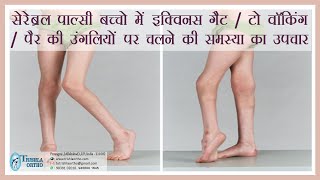 Treatment of Equinus gait toe walking walking on toes in cerebral palsy treatment at Trishla [upl. by Durware671]