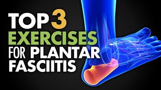 Plantar Fasciitis Causes Diagnosis and Treatment [upl. by Alisa]