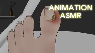 고막에 때려박는 팅글 사운드 리얼한 내성 발톱 치료 애니메이션 ASMR  Ingrown Toenail Removal treatment [upl. by Melburn]