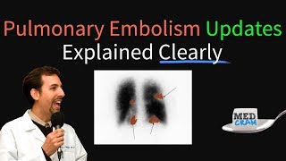 Pulmonary Embolism  Thromboembolism Updates Explained Clearly [upl. by Suivatnom]