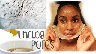 DIY Milk Peel Off Mask UNPLUG Blackheads Whiteheads amp Unwanted Hair [upl. by Asyram]