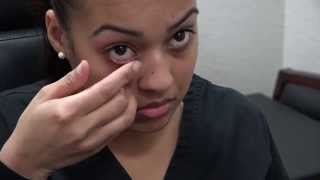 How to Apply Ointment to the Eyes and Eyelids [upl. by Britte]