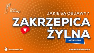 ZAKRZEPICA ŻYLNA  jakie są jej objawy [upl. by Naelopan]