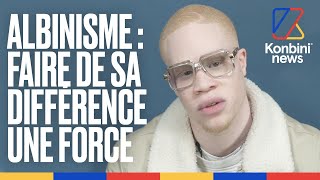 Hassan Koné  quotKalash Criminel m’a aidé à avoir plus confiance en moiquot  Fier dêtre albinos [upl. by Jessee]