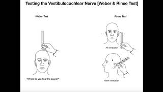 Interpreting the WeberRinne Tests EXPLAINED [upl. by Beverie]