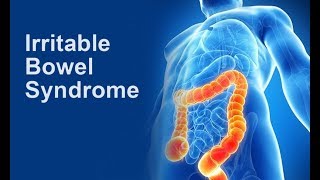 Irritable Bowel Syndrome [upl. by Eugaet]