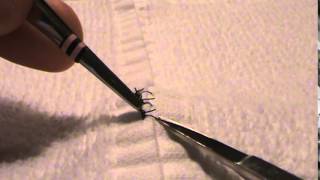 How to Remove Sutures [upl. by Ellienad750]