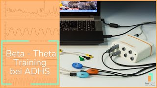 Neurofeedback BetaTheta Training bei ADHS [upl. by Henn770]