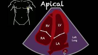 Bedside Ultrasound Basic Cardiac US [upl. by Avon]