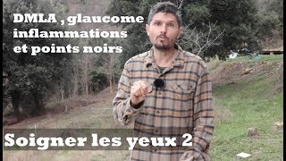 DMLA  glaucome inflammations et points noirs  Soigner les yeux épisode 2  regenereorg [upl. by Eddy]