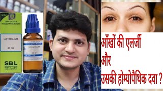 Eye Allergy  Eye itching  Homeopathic Medicine for allergic conjunctivitis  Explain [upl. by Eihcra]