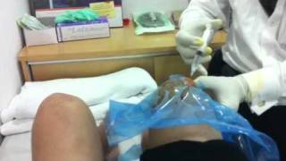 Knee injection of Hyaluronic Acid [upl. by Eiruam]