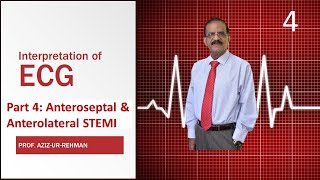 ECG Part 4 Anteroseptal amp Anterolateral STEMI final [upl. by Aehsrop983]