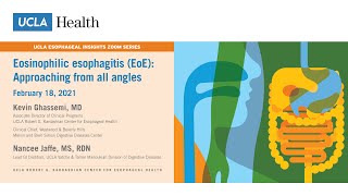 Patient education Esophageal varices The Basics [upl. by Nawuq]