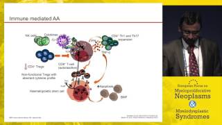 Hypocellular MDS vs aplastic anemia  Diagnosis and therapy [upl. by Tiernan]