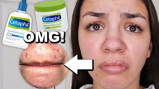 I Used Cetaphil Skincare For One Week [upl. by Edals528]