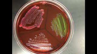 Coliform presence using Eosin Methylene Blue EMB Agar Plate  Botany [upl. by Eedeed]