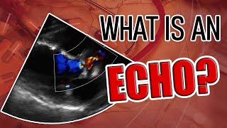 What is an Echocardiogram [upl. by Nauh]