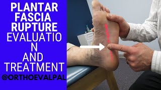 Plantar Fasciitis Post Tibial Block and PRP Injections [upl. by Priscella]