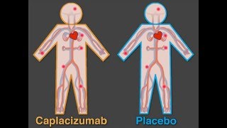 Pediatric Immune Thrombocytopenia Purpura [upl. by Ydospahr]