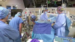 Initiation of Cardiopulmonary Bypass  Improved [upl. by Isoj]