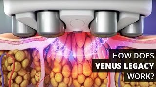 How Does Venus Legacy™ Work [upl. by Nebur119]