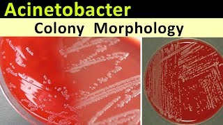 Acinetobacter Colony Morphology [upl. by Fiester]