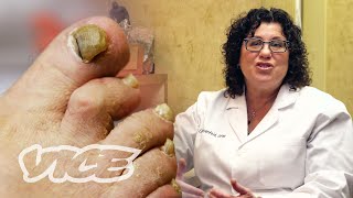 Meet a Toenail Fungus Expert [upl. by Ahtebbat]