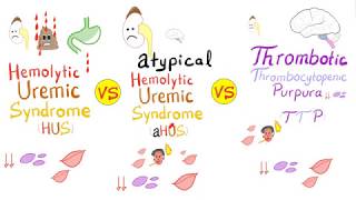 HUS vs aHUS vs TTP [upl. by Shah]