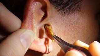 Technique japonaise pour déboucher les oreilles 3 ASMR [upl. by Maleeny]