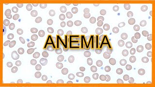 Anemia Types Findings Lab Values [upl. by Eladal]