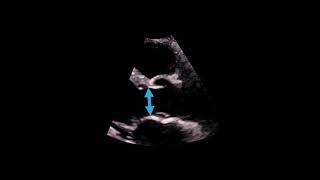 Thoracic Descending Aorta Anatomy amp Branches  Kenhub [upl. by Romney]