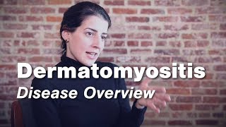 Dermatomyositis  Disease Overview  Johns Hopkins [upl. by Aisul]