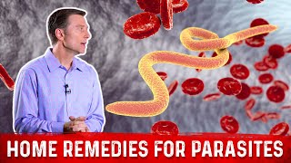 Best Home Remedies for Parasites – Dr Berg [upl. by Hannus]