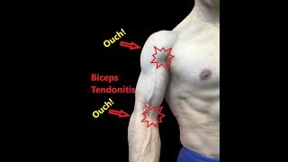 Biceps Tendonitis Treatment At Home Relieve Pain Fast [upl. by Nallek132]