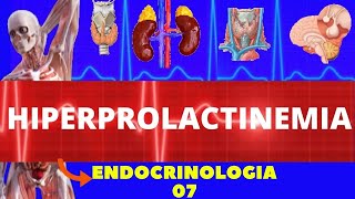 HIPERPROLACTINEMIA AUMENTO DE PROLACTINA  ENDOCRINOLOGIA [upl. by Genni]