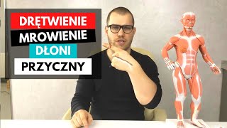 MROWIENIE I DRĘTWIENIE DŁONI  TOP 3 przyczyny ucisku na nerw [upl. by Aihsiyt367]