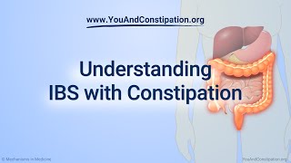 Understanding IBS with Constipation [upl. by Gisella]