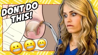 Doctor reacts Ingrown nail gone wrong [upl. by Garek945]